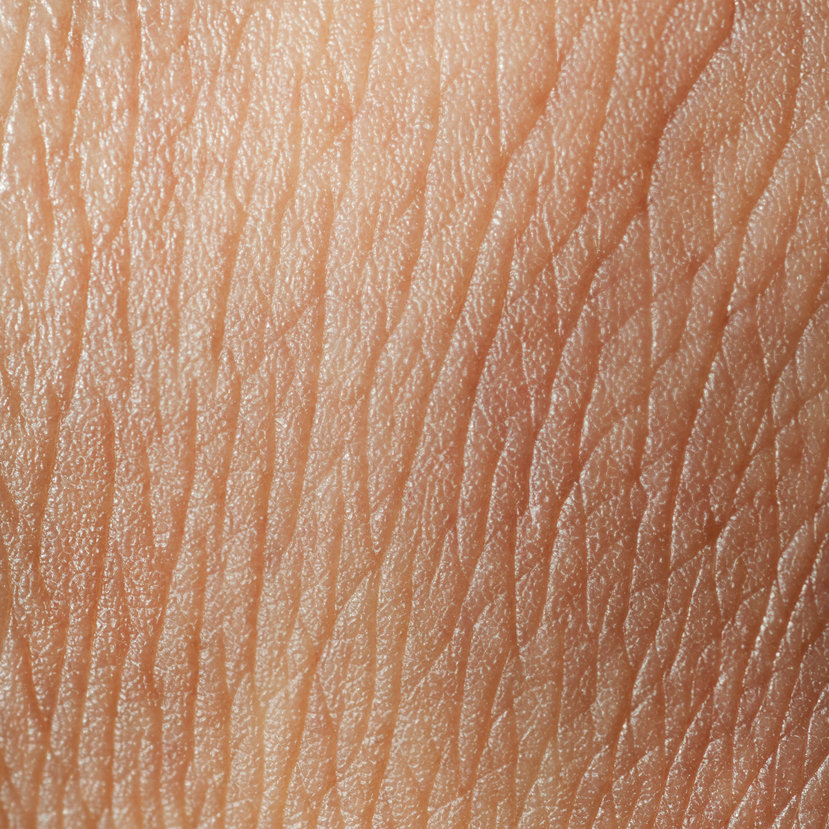 Skin Rinds Retouch Skin Lab | Medicinsk hudpleje